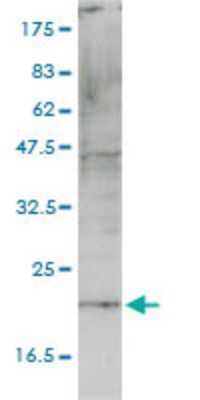 Western Blot: CNIH4 Antibody (4E10-1G4) [H00029097-M01]