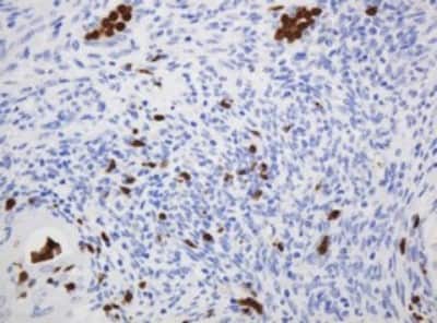 Immunohistochemistry: CNKSR3 Antibody (OTI1D7) [NBP2-45630]