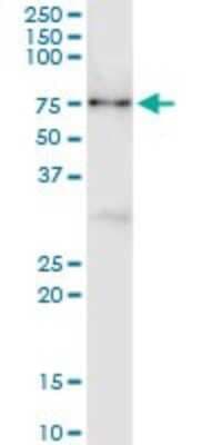 Immunoprecipitation: CNKSR3 Antibody (4A11) [H00154043-M01]