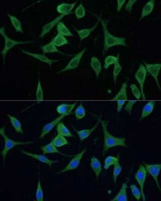 Immunocytochemistry/ Immunofluorescence: CNNM1 Antibody - Azide and BSA Free [NBP3-15497]