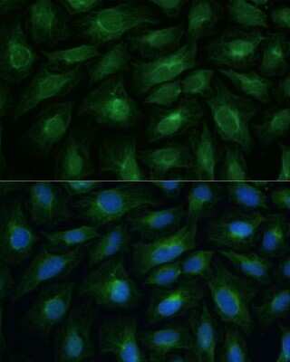Immunocytochemistry/ Immunofluorescence: CNNM1 Antibody - Azide and BSA Free [NBP3-15497]