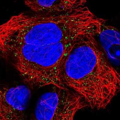 Immunocytochemistry/ Immunofluorescence: CNNM2 Antibody [NBP2-57086]