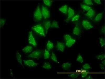 Immunocytochemistry/ Immunofluorescence: CNO Antibody (6C3) [H00055330-M02]