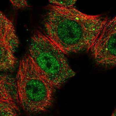 Immunocytochemistry/ Immunofluorescence: CNOT10 Antibody [NBP2-58959]
