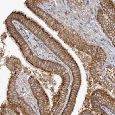 Immunohistochemistry-Paraffin: CNOT10 Antibody [NBP1-82278]