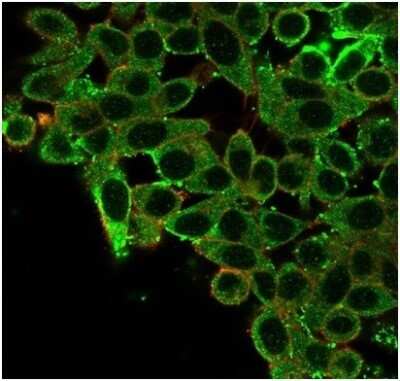 Immunocytochemistry/ Immunofluorescence: CNOT10 Antibody (PCRP-CNOT10-1D5) [NBP3-13921]