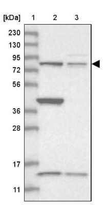 Western Blot: CNOT10 Antibody [NBP1-82278]