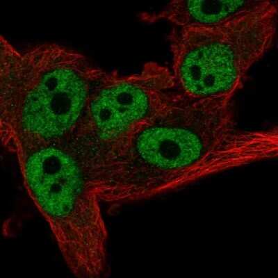 Immunocytochemistry/ Immunofluorescence: CNOT11 Antibody [NBP2-55823]