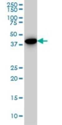 Western Blot: CNOT2 Antibody (3F1) [H00004848-M08]