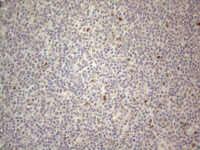Immunohistochemistry: CNOT2 Antibody (OTI5A12) [NBP2-46323]