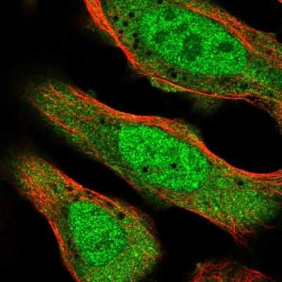 Immunocytochemistry/ Immunofluorescence: CNOT2 Antibody [NBP2-56034]