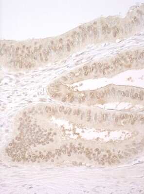 Immunohistochemistry: CNOT2 Antibody [NBP2-04083]