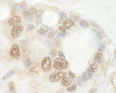 Immunohistochemistry-Paraffin: CNOT2 Antibody [NBP1-30454]