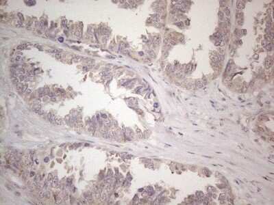 Immunohistochemistry: CNOT2 Antibody (OTI5A12) - Azide and BSA Free [NBP2-71202]