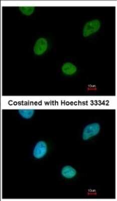 Immunocytochemistry/ Immunofluorescence: CNOT3 Antibody [NBP2-15928]