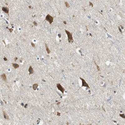 Immunohistochemistry-Paraffin: CNOT3 Antibody [NBP1-82971]