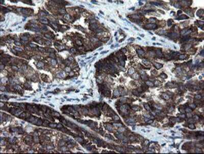 Immunohistochemistry-Paraffin: CNOT4 Antibody (OTI1H2) [NBP2-03878]