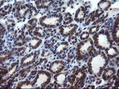 Immunohistochemistry-Paraffin: CNOT4 Antibody (OTI1H2) [NBP2-03878]