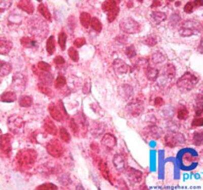 Immunohistochemistry-Paraffin: CNOT4 Antibody [NBP2-24527]