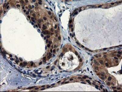 Immunohistochemistry: CNOT4 Antibody (OTI1H2) - Azide and BSA Free [NBP2-71212]
