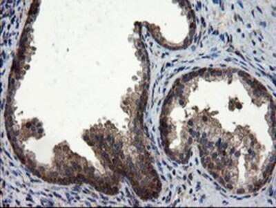 Immunohistochemistry: CNOT4 Antibody (OTI1H2) - Azide and BSA Free [NBP2-71212]