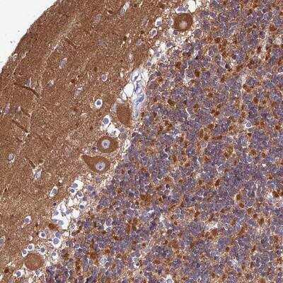 Immunohistochemistry-Paraffin: CNOT6 Antibody [NBP1-86564]