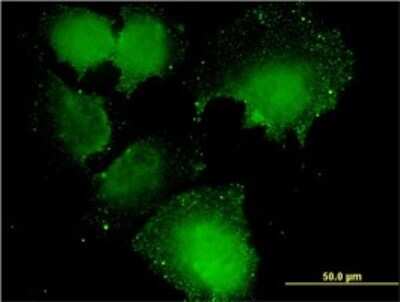 Immunocytochemistry/ Immunofluorescence: CNOT7 Antibody (2F6) [H00029883-M01]