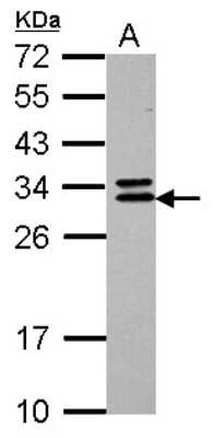 Western Blot: CNOT7 Antibody [NBP2-15929]