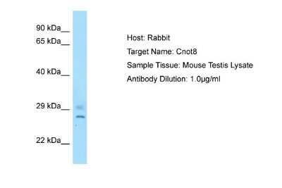 Western Blot: CNOT8 Antibody [NBP1-98337]