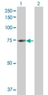 Western Blot: CNOX Antibody [H00055068-B01P]