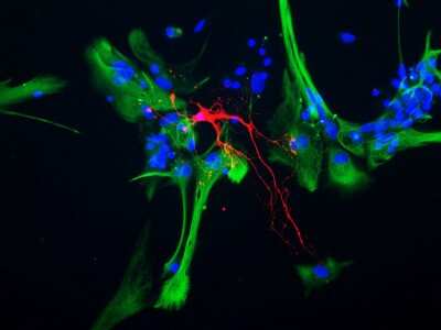 Immunocytochemistry/ Immunofluorescence: CNPase Antibody (1H10) [NBP2-50031]