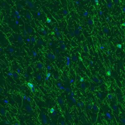 Immunohistochemistry: CNPase Antibody (CL2872) [NBP2-46636]