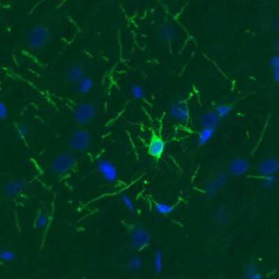 Immunohistochemistry: CNPase Antibody (CL2872) [NBP2-46636]