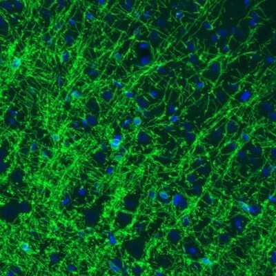 Immunohistochemistry: CNPase Antibody (CL2871) [NBP2-46635]