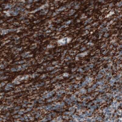 Immunohistochemistry-Paraffin: CNPase Antibody (CL2871) [NBP2-46635]
