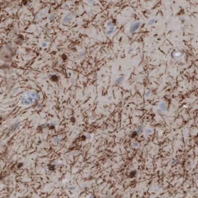 Immunohistochemistry-Paraffin: CNPase Antibody (CL2871) [NBP2-46635]
