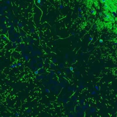 Immunohistochemistry: CNPase Antibody (CL2887) [NBP2-46617]