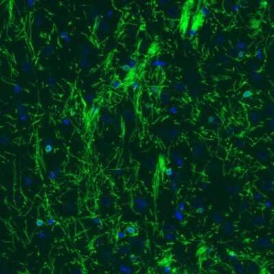Immunohistochemistry: CNPase Antibody (CL2887) [NBP2-46617]