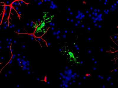 Immunocytochemistry/ Immunofluorescence: CNPase Antibody [NBP2-50058]