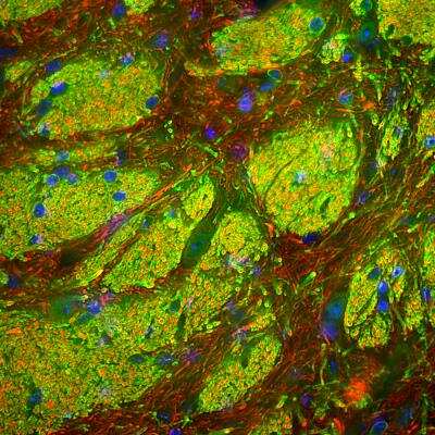 Immunocytochemistry/ Immunofluorescence: CNPase Antibody [NBP3-05551]