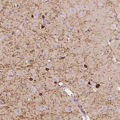 Immunohistochemistry-Paraffin: CNPase Antibody [NBP1-85998]