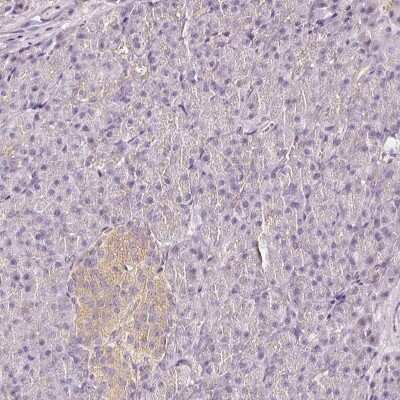 Immunohistochemistry-Paraffin: CNPase Antibody [NBP1-85998]