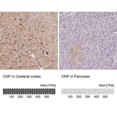 Immunohistochemistry-Paraffin: CNPase Antibody [NBP1-85998]