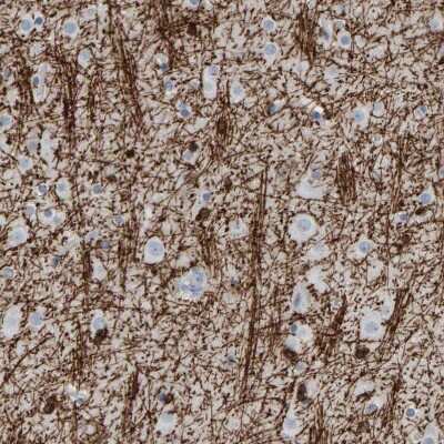 Immunohistochemistry-Paraffin: CNPase Antibody [NBP1-85999]