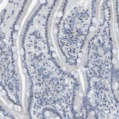Immunohistochemistry-Paraffin: CNPase Antibody [NBP1-85999]