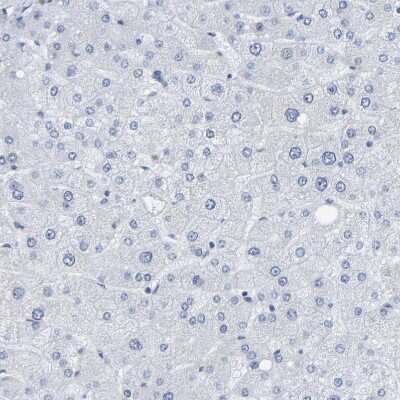 Immunohistochemistry-Paraffin: CNPase Antibody [NBP1-85999]