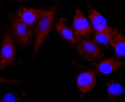 Immunocytochemistry/ Immunofluorescence: CNPase Antibody (JF10-25) [NBP2-66986]