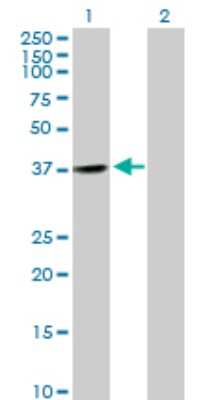 Western Blot: CNTD Antibody [H00124817-B01P]