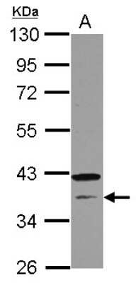 Western Blot: CNTD Antibody [NBP2-15932]