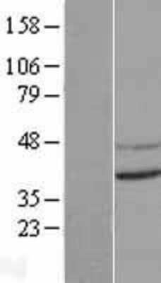 Western Blot: CNTD Overexpression Lysate [NBL1-09330]